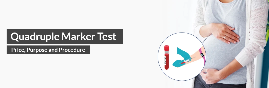 Quadruple Marker Test - Price, Purpose, Procedure